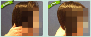 Illustration for article titled "Round Head" Plastic Surgery Seems Excessive, Even for South Korea